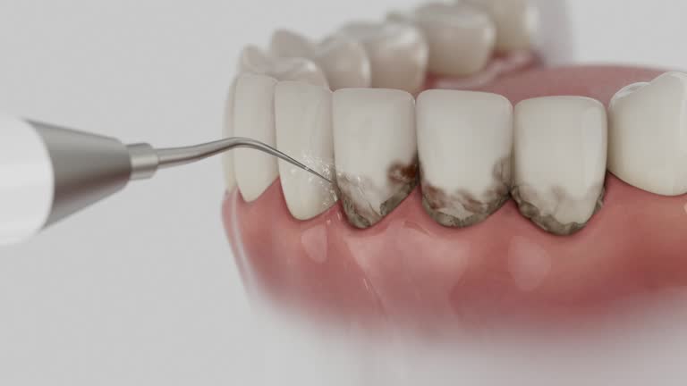 Reliable Dental Implants contractor in Hobe Sound, FL by Smile Center Dentistry